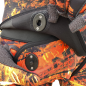 Remplacement clips de sous-cutale
